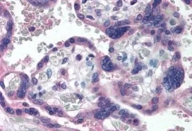 Anti-p73 delta N antibody [38C674.2] used in IHC (Paraffin sections) (IHC-P). GTX11997