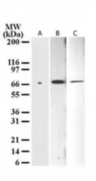Anti-p73 delta N antibody [38C674.2] used in Western Blot (WB). GTX11997