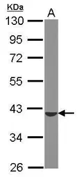 Anti-ST6GALNAC4 antibody [N2C3] used in Western Blot (WB). GTX119976