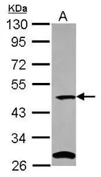 Anti-C9orf43 antibody [N2C2], Internal used in Western Blot (WB). GTX119982