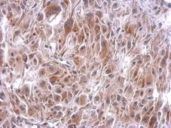 Anti-SLFNL1 antibody [N2C2], Internal used in IHC (Paraffin sections) (IHC-P). GTX119984