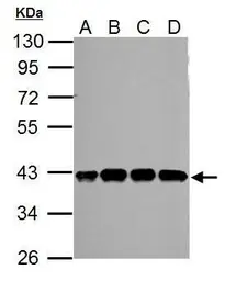 Anti-SLFNL1 antibody [N2C2], Internal used in Western Blot (WB). GTX119984