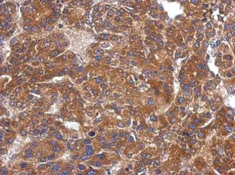 Anti-ARHGAP36 antibody used in IHC (Paraffin sections) (IHC-P). GTX119985