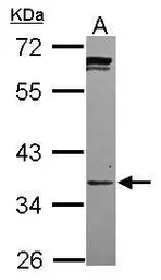 Anti-PPCS antibody [N2C3] used in Western Blot (WB). GTX119988