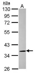 Anti-ELMOD1 antibody [N2C3] used in Western Blot (WB). GTX120004