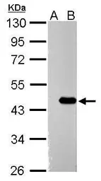 Anti-ZBTB24 antibody used in Western Blot (WB). GTX120013