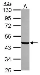 Anti-C8orf30A antibody [N2C3] used in Western Blot (WB). GTX120021
