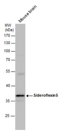 Anti-Sideroflexin 5 antibody used in Western Blot (WB). GTX120024