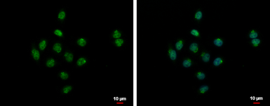 Anti-SYAP1 antibody [N3C3] used in Immunocytochemistry/ Immunofluorescence (ICC/IF). GTX120025