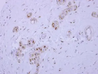 Anti-SYAP1 antibody [N3C3] used in IHC (Paraffin sections) (IHC-P). GTX120025