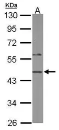 Anti-SYAP1 antibody [N3C3] used in Western Blot (WB). GTX120025