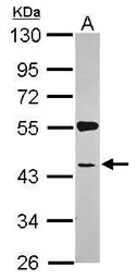 Anti-SYAP1 antibody [N3C3] used in Western Blot (WB). GTX120025