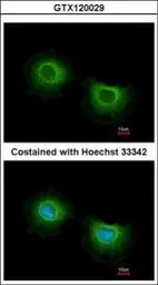 Anti-ST3GAL3 antibody used in Immunocytochemistry/ Immunofluorescence (ICC/IF). GTX120029
