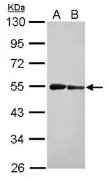 Anti-ST3GAL3 antibody used in Western Blot (WB). GTX120029