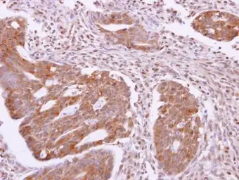 Anti-SH3GLB2 antibody used in IHC (Paraffin sections) (IHC-P). GTX120037