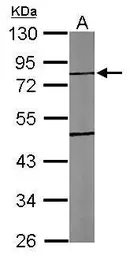 Anti-TTLL10 antibody [N3C2], Internal used in Western Blot (WB). GTX120045