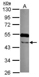 Anti-TTLL10 antibody [N3C2], Internal used in Western Blot (WB). GTX120045
