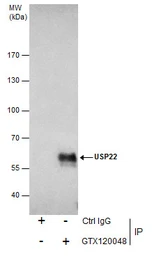 Anti-USP22 antibody [N3C3] used in Immunoprecipitation (IP). GTX120048