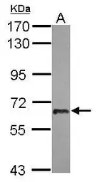 Anti-USP22 antibody [N3C3] used in Western Blot (WB). GTX120048