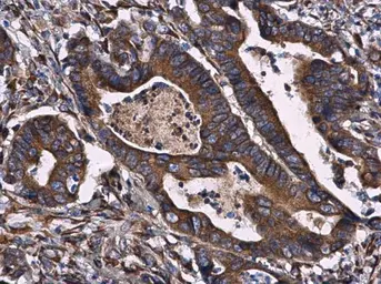 Anti-CKAP4 antibody [N3C3] used in IHC (Paraffin sections) (IHC-P). GTX120087