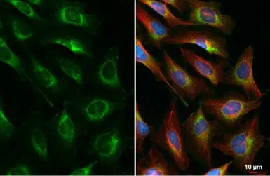 Anti-CKAP4 antibody [N3C3] used in Immunocytochemistry/ Immunofluorescence (ICC/IF). GTX120087