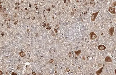 Anti-CKAP4 antibody [N3C3] used in IHC (Paraffin sections) (IHC-P). GTX120087