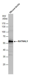 Anti-KATNAL1 antibody [C1C3] used in Western Blot (WB). GTX120095