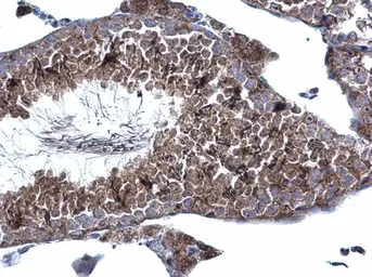 Anti-KATNAL1 antibody [C1C3] used in IHC (Paraffin sections) (IHC-P). GTX120095