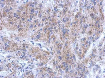 Anti-KATNAL1 antibody [C1C3] used in IHC (Paraffin sections) (IHC-P). GTX120095