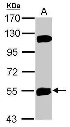 Anti-KATNAL1 antibody [C1C3] used in Western Blot (WB). GTX120095