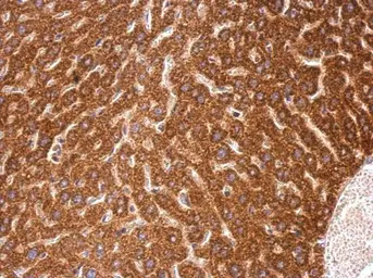 Anti-C4orf14 antibody [N3C2], Internal used in IHC (Paraffin sections) (IHC-P). GTX120100