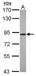 Anti-C4orf14 antibody [N3C2], Internal used in Western Blot (WB). GTX120100