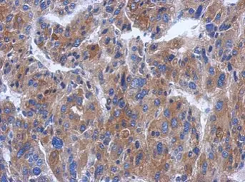 Anti-CWF19L1 antibody [C1C3] used in IHC (Paraffin sections) (IHC-P). GTX120118