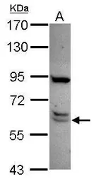 Anti-CWF19L1 antibody [C1C3] used in Western Blot (WB). GTX120118