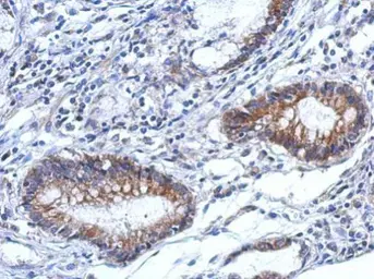 Anti-TARS2 antibody [N3C2], Internal used in IHC (Paraffin sections) (IHC-P). GTX120121