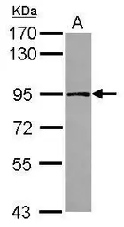 Anti-TARS2 antibody [N3C2], Internal used in Western Blot (WB). GTX120121