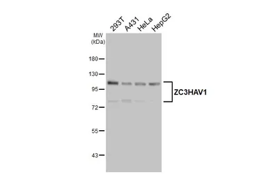 Anti-ZC3HAV1 antibody [N3C2], Internal used in Western Blot (WB). GTX120134