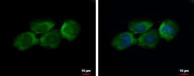 Anti-C12orf11 antibody used in Immunocytochemistry/ Immunofluorescence (ICC/IF). GTX120137