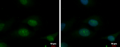 Anti-TBL3 antibody used in Immunocytochemistry/ Immunofluorescence (ICC/IF). GTX120142