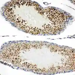 Anti-TIM-1 antibody used in IHC (Paraffin sections) (IHC-P). GTX12016