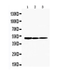 Anti-TIM-1 antibody used in Western Blot (WB). GTX12016