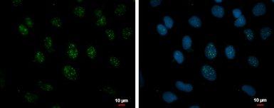 Anti-NPD014 antibody used in Immunocytochemistry/ Immunofluorescence (ICC/IF). GTX120166