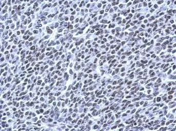 Anti-NPD014 antibody used in IHC (Paraffin sections) (IHC-P). GTX120166