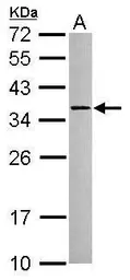 Anti-NPD014 antibody used in Western Blot (WB). GTX120166