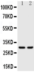 Anti-Kallikrein 1 antibody used in Western Blot (WB). GTX12017