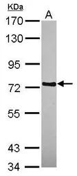Anti-WDR65 antibody [N1N2], N-term used in Western Blot (WB). GTX120170