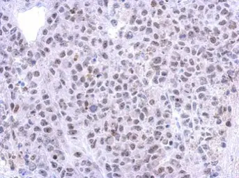 Anti-RRP12 antibody [N1N2], N-term used in IHC (Paraffin sections) (IHC-P). GTX120180