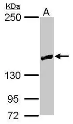 Anti-RRP12 antibody [N1N2], N-term used in Western Blot (WB). GTX120180