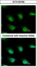 Anti-KIAA0323 antibody [C2C3], C-term used in Immunocytochemistry/ Immunofluorescence (ICC/IF). GTX120182