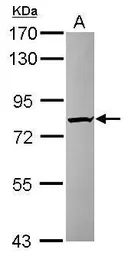 Anti-KIAA0323 antibody [C2C3], C-term used in Western Blot (WB). GTX120182